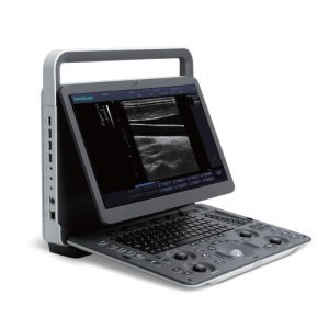 Ecografo portatile Sonoscape E1 EXP aperto con schermo touch e tastiera, immagine ecografica a ultrasuoni visualizzata sul monitor